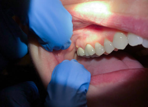 Best Emergency Cosmetic Dentistry in Ponderosa Park, CO