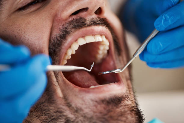 Best Emergency Dental Services for Seniors in Ponderosa Park, CO