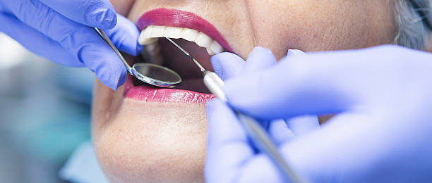 Best Emergency Dentist for Lost Fillings or Crowns in Ponderosa Park, CO